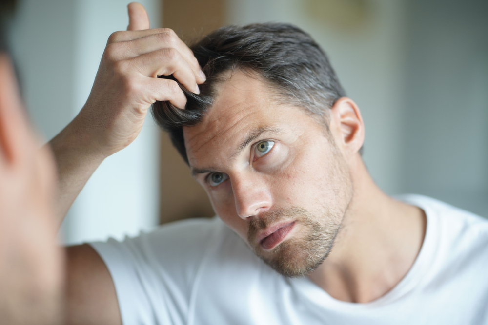 iron deficiency hair loss